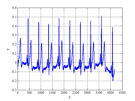 Ряд электрокардиограммы с исключенным тригонометрическим трендом